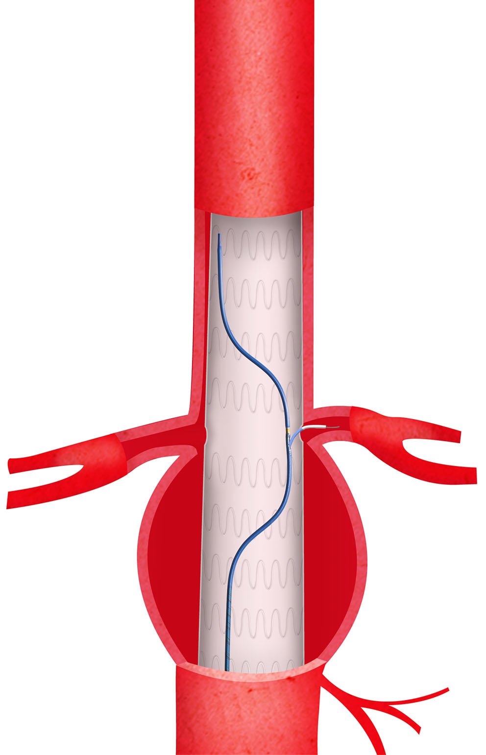 Aorta 01