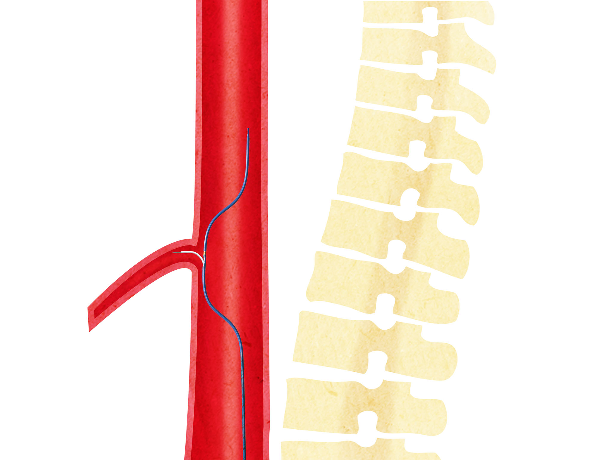 Aorta 02