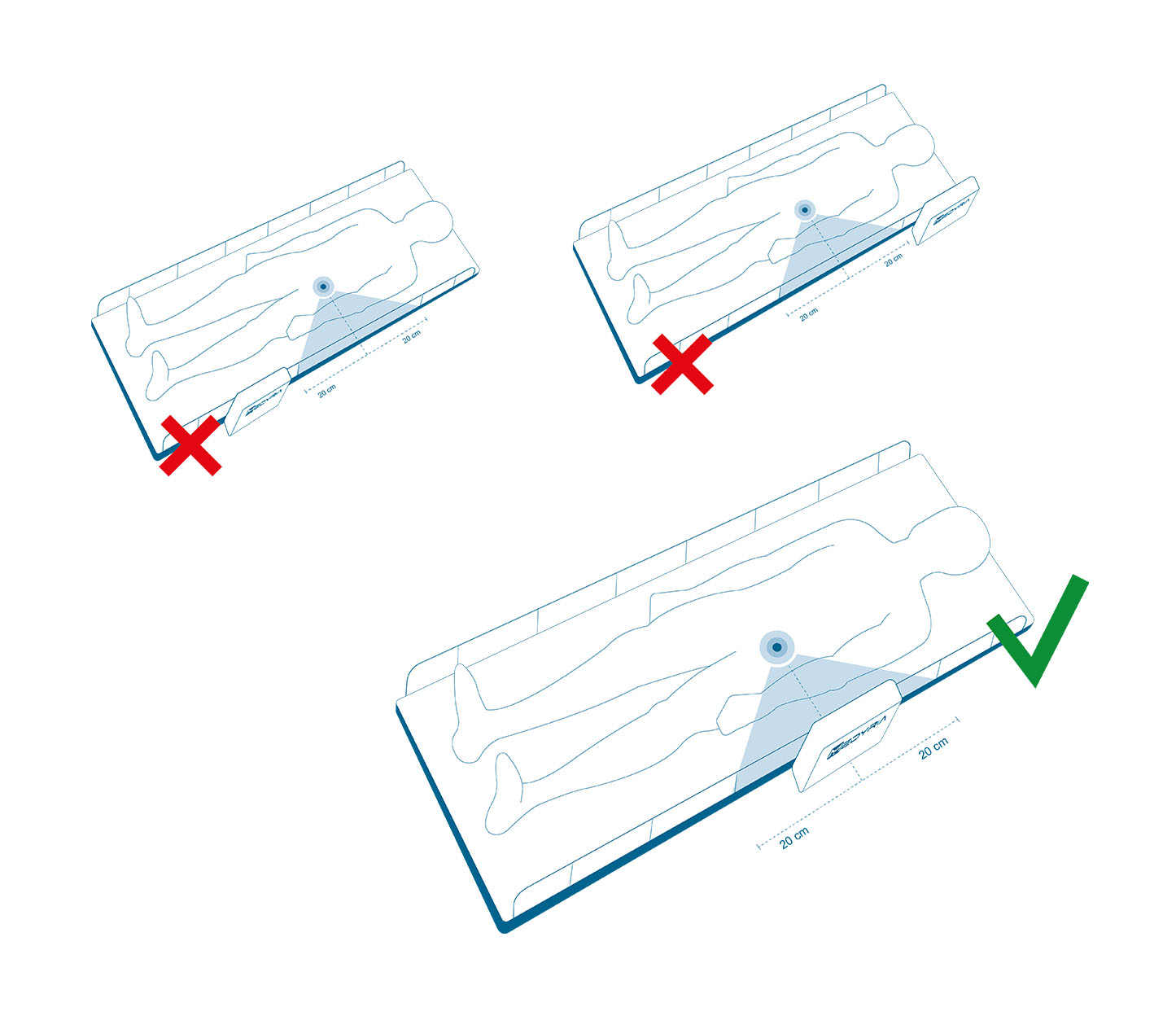 TrackCath Placement 02