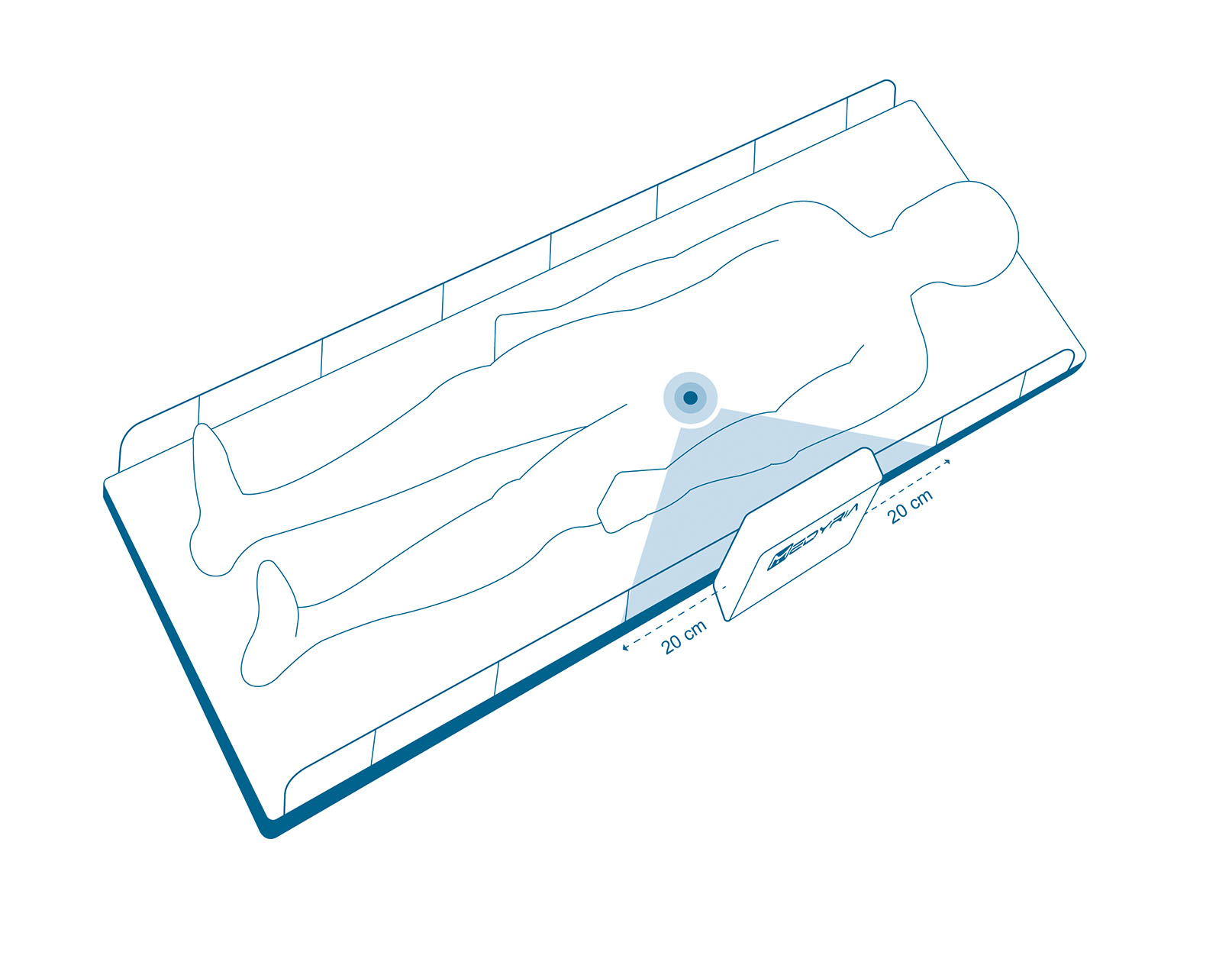 TrackCath Placement