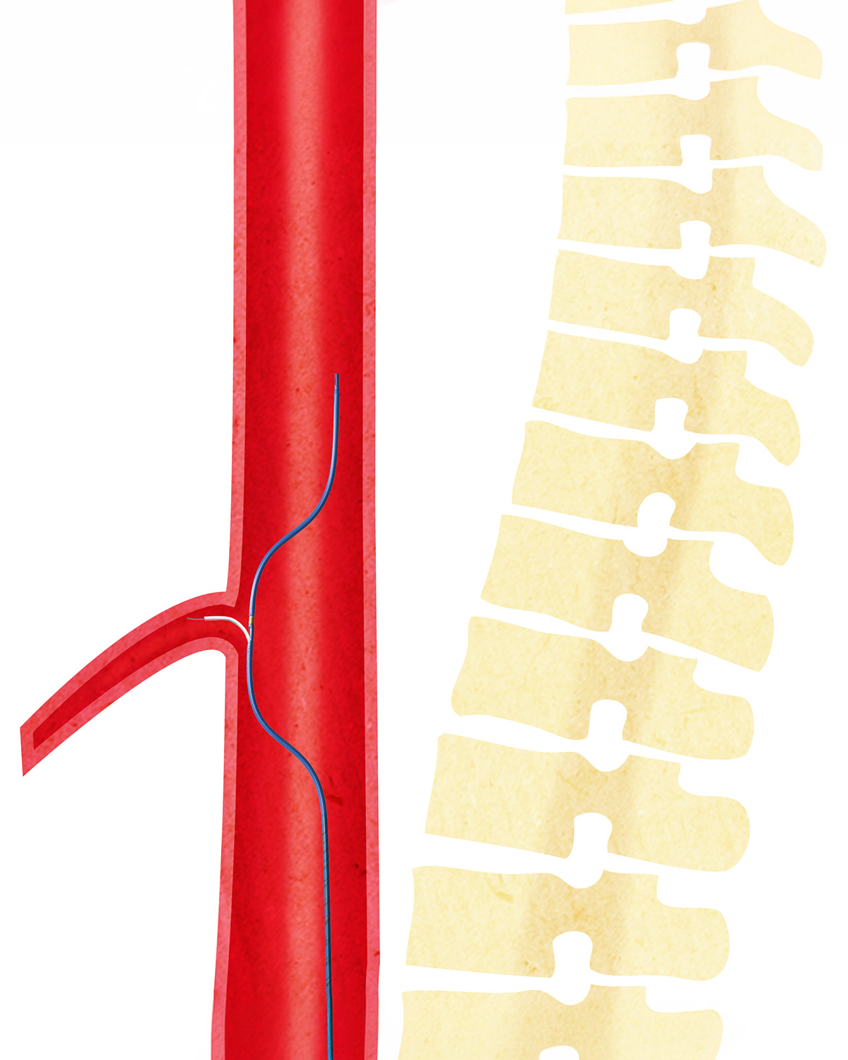 Aorta 01