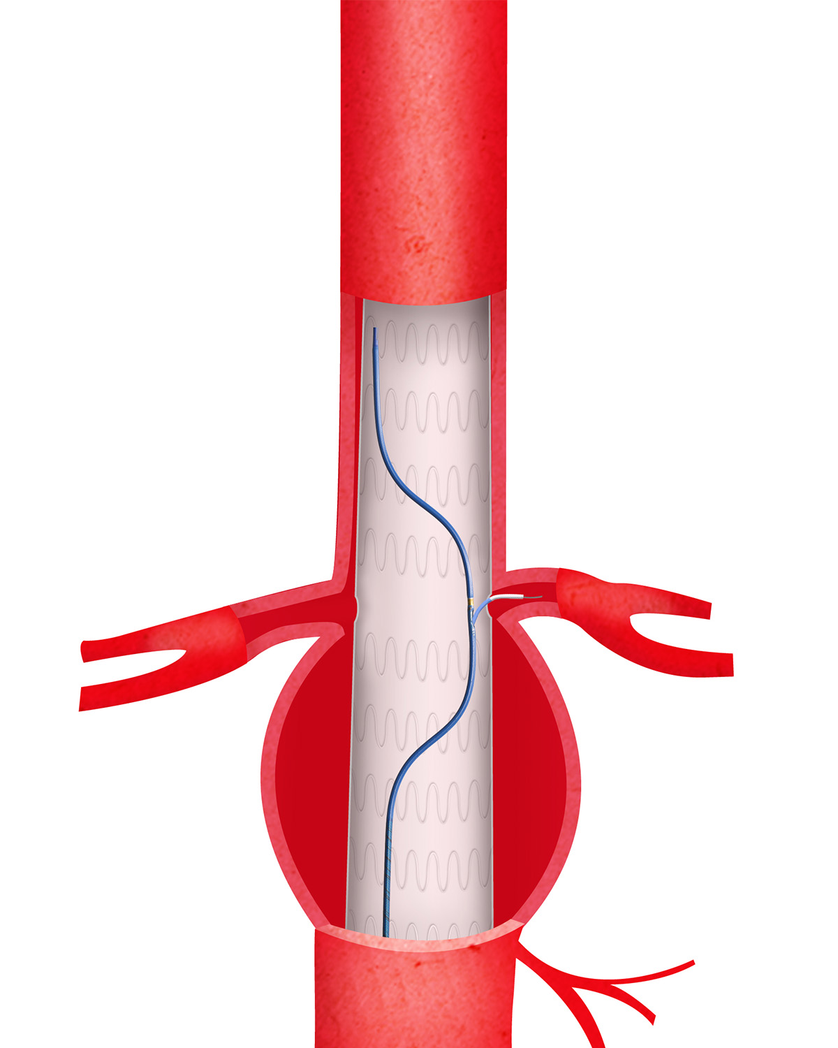 Aorta 02