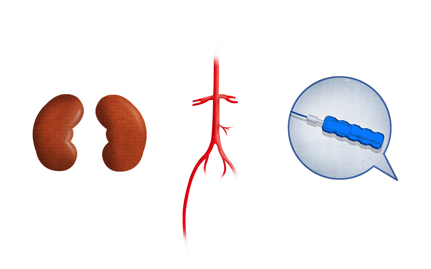 Kidney 02