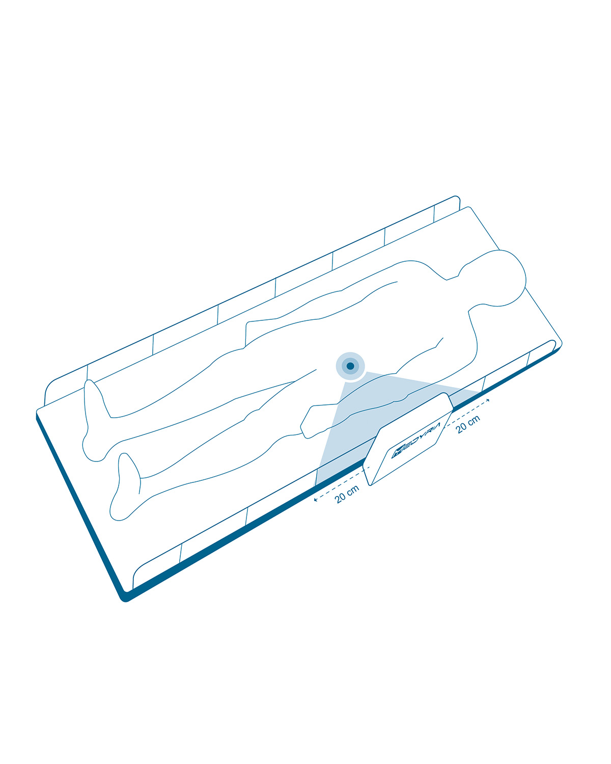 TrackCath 01